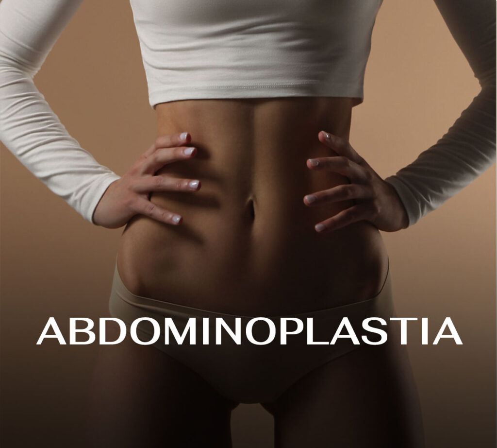 Abdominoplastia- Dra. Andréa Carneiro Álvares - Cirurgia Plástica Maringá